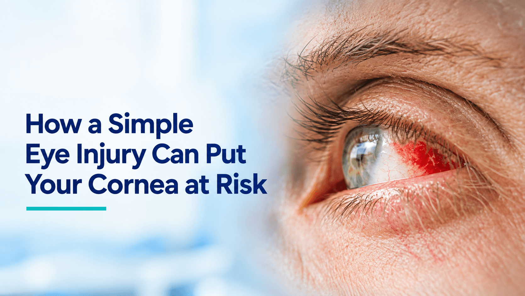 How a Simple Eye Injury Can Put Your Cornea at Risk